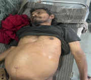 अनोळखी बेवारस मयत इसम  वय 50